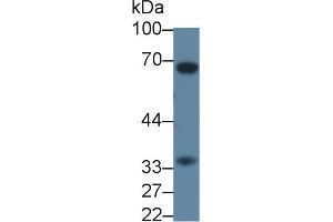 Western blot analysis of Rat Liver lysate, using Rat CASP7 Antibody (3 µg/ml) and HRP-conjugated Goat Anti-Rabbit antibody (