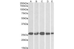 ABIN4902592 (1µg/ml) staining of NIH3T3 (A), HeLa (B), K562 (C), MCF7 (D) and HepG2 (E) lysates (35µg protein in RIPA buffer). (CSNK2B antibody)