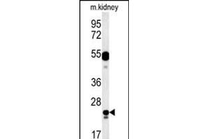 LYSMD1 Antibody (C-term) (ABIN651931 and ABIN2840459) western blot analysis in mouse kidney tissue lysates (15 μg/lane). (LYSMD1 antibody  (C-Term))