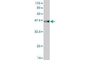 Western Blotting (WB) image for anti-ATP-Binding Cassette, Sub-Family F (GCN20), Member 2 (ABCF2) (AA 1-110) antibody (ABIN564348)