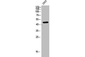 Western Blot analysis of 293T cells using CLN5 Polyclonal Antibody (CLN5 antibody  (Internal Region))