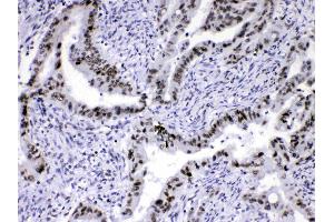 Immunohistochemistry (IHC) image for anti-Heterogeneous Nuclear Ribonucleoprotein A1 (HNRNPA1) (AA 8-42), (N-Term) antibody (ABIN4886621)