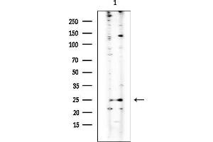 anti-Tumor Suppressor Candidate 1 (TUSC1) antibody
