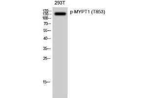 Western Blotting (WB) image for anti-Myosin Phosphatase, Target Subunit 1 (PPP1R12A) (pThr853) antibody (ABIN3182548) (PPP1R12A antibody  (pThr853))