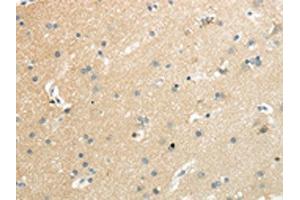 The image on the left is immunohistochemistry of paraffin-embedded Human brain tissue using ABIN7192521(SLC7A11 Antibody) at dilution 1/35, on the right is treated with synthetic peptide. (SLC7A11 antibody)