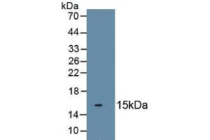 Detection of Recombinant TWIST, Human using Polyclonal Antibody to Twist Transcription Factor (TWIST) (TWIST1 antibody  (AA 102-202))