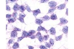 Anti-GPR17 antibody immunocytochemistry (ICC) staining of untransfected HEK293 human embryonic kidney cells. (GPR17 antibody  (N-Term))