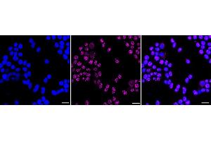 Immunocytochemical staining of HeLa cells with MOV10 antibody (ABIN7799485), 1:1,000).