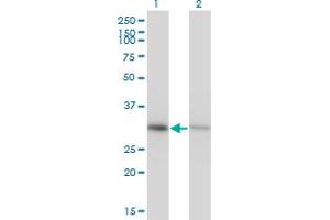 Western Blot analysis of ANXA4 expression in transfected 293T cell line by ANXA4 monoclonal antibody (M13), clone 1D3. (Annexin IV antibody  (AA 1-321))