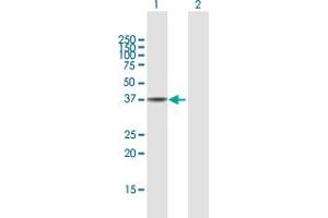 Western Blot analysis of HSP90B1 expression in transfected 293T cell line by HSP90B1 MaxPab polyclonal antibody. (GRP94 antibody  (AA 1-315))