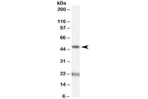 Western blot testing of human brain (substantia nigra) lysate with Acylglycerol kinase antibody at 1ug/ml. (Acylglycerol Kinase antibody)