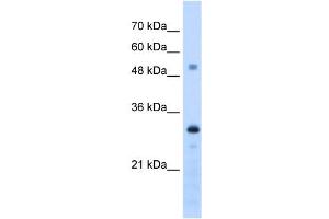 PSME3 antibody used at 1. (PSME3 antibody  (C-Term))