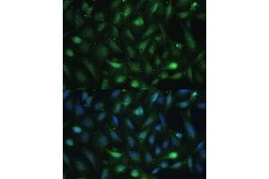 Immunofluorescence analysis of U-2 OS cells using Casein Kinase 2 beta (Casein Kinase 2 beta (CSNK2B)) Polyclonal Antibody (ABIN7266104) at dilution of 1:100 (40x lens). (CSNK2B antibody  (AA 1-215))