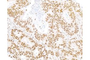 Immunohistochemistry (IHC) image for anti-5'-3' Exoribonuclease 2 (XRN2) (AA 900-950) antibody (ABIN7454718)