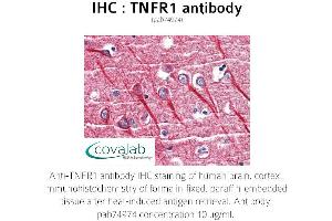 Image no. 1 for anti-Tumor Necrosis Factor Receptor Superfamily, Member 1A (TNFRSF1A) antibody (ABIN1740186)