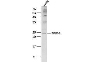A549 lysates probed with TIMP-2 Polyclonal Antibody, Unconjugated  at 1:300 dilution and 4˚C overnight incubation. (TIMP2 antibody  (AA 51-150))