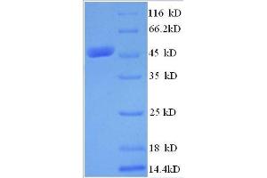 MYST Histone Acetyltransferase 2 (MYST2) (AA 1-214), (partial) protein (GST tag)