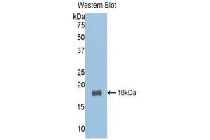 Western Blotting (WB) image for anti-Transcription Factor 20 (TCF20) (AA 392-524) antibody (ABIN1860690)