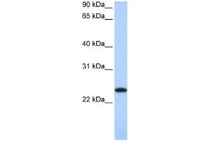 FTL antibody used at 1 ug/ml to detect target protein. (FTL antibody  (Middle Region))