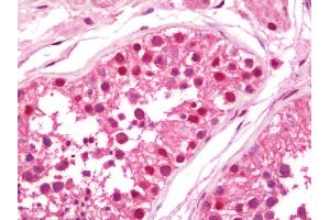 Anti-UBA1 / UBE1 antibody IHC staining of human testis. (UBA1 antibody  (AA 800-850))