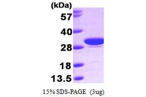 SDS-PAGE (SDS) image for Carbonic Anhydrase I (CA1) (AA 1-261) protein (His tag) (ABIN666911) (CA1 Protein (AA 1-261) (His tag))