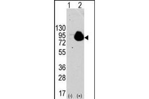Western blot analysis of RPS6KA1 (arrow) using rabbit polyclonal RPS6KA1 Antibody . (RPS6KA1 antibody  (AA 710-735))