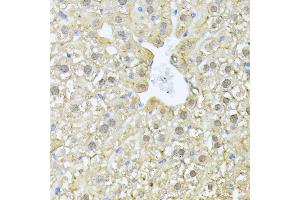 Immunohistochemistry of paraffin-embedded mouse liver using PSM antibody (ABIN1682332, ABIN3018467, ABIN3018468 and ABIN6220474) at dilution of 1:100 (40x lens). (PSMA7 antibody  (AA 1-248))