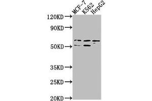 anti-Ubiquitin Specific Peptidase 17-Like Family Member 3 (USP17L3) (AA 19-251), (C-Term) antibody