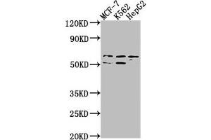 Western Blot Positive WB detected in: MCF-7 whole cell lysate, K562 whole cell lysate, HepG2 whole cell lysate All lanes: USP17L3 antibody at 1:1000 Secondary Goat polyclonal to rabbit IgG at 1/50000 dilution Predicted band size: 60 kDa Observed band size: 60 kDa (USP17L3 antibody  (C-Term))