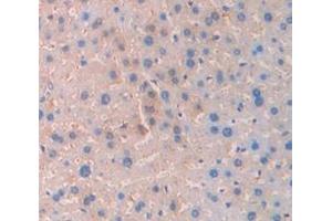 Figure. (SERPINC1 antibody  (AA 33-465))