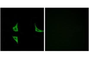 Immunofluorescence analysis of COS7 cells, using CaMK2 (Phospho-Thr286) Antibody. (CAMK2B antibody  (pThr286))