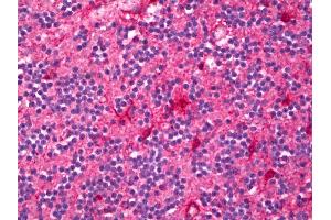 Anti-ENPP2 / Autotaxin antibody IHC of human brain, cerebellum. (ENPP2 antibody)