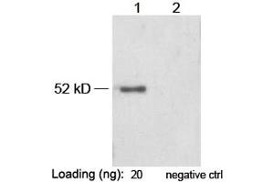 Lane 1: VSV-G-tag fusion protein in Hela cell lysate (~ 52 kD) Lane 2: Negative Hela cell lysateAntibody: 1 µg/mL Rabbit Anti-VSV-G-tag [HRP] Polyclonal Antibody (ABIN398532) The signal was developed with LumiSensorTM HRP Substrate Kit (ABIN769939)