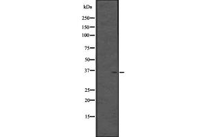 Western blot analysis of CPXCR1 expression in Fetal brain lysate (Human) ;,The lane on the left is treated with the antigen-specific peptide. (CPXCR1 antibody)