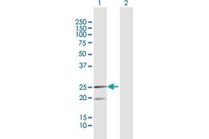 Western Blot analysis of MRPL12 expression in transfected 293T cell line by MRPL12 MaxPab polyclonal antibody. (MRPL12 antibody  (AA 1-198))