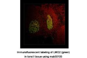 Image no. 1 for anti-LIM Domain Only 2 (Rhombotin-Like 1) (LMO2) antibody (ABIN363259) (LMO2 antibody)