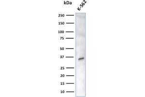 Western Blot Analysis of K-562 cell lysate using CA8 Mouse Monoclonal Antibody (CPTC-CA8-2).