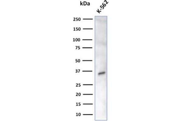 CA8 anticorps