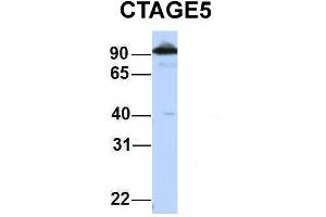 Host:  Rabbit  Target Name:  CTAGE5  Sample Type:  HepG2  Antibody Dilution:  1. (MIA2 antibody  (Middle Region))
