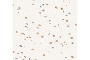 Immunohistochemistry of paraffin embedded rat brain using SUPT3H (ABIN7075767) at dilution of 1: 1500 (400x lens)