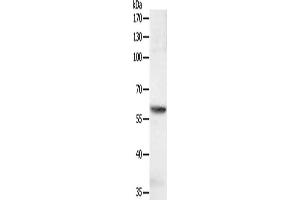 Gel: 10 % SDS-PAGE, Lysate: 40 μg, Lane: jurkat cells, Primary antibody: ABIN7131139(SOCS6 Antibody) at dilution 1/600, Secondary antibody: Goat anti rabbit IgG at 1/8000 dilution, Exposure time: 1 second (SOCS6 antibody)