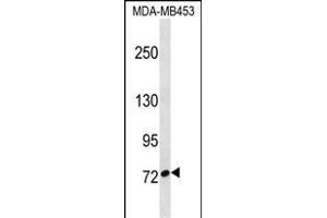 CUX1 Antibody (C-term) (ABIN1537517 and ABIN2850213) western blot analysis in MDA-M cell line lysates (35 μg/lane). (CUX1 antibody  (C-Term))