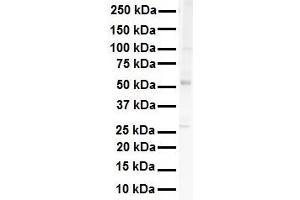 WB Suggested Anti-SNRP70 antibody Titration: 1 ug/mL Sample Type: HEK293 (SNRNP70 antibody  (N-Term))