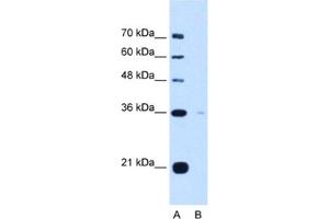Western Blotting (WB) image for anti-Torsin Family 1, Member B (Torsin B) (TOR1B) antibody (ABIN2463038) (TOR1B antibody)