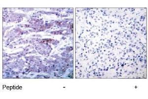 Image no. 1 for anti-BCL2-Associated Agonist of Cell Death (BAD) (Ser112) antibody (ABIN197208)
