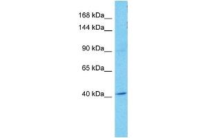 Host:  Rabbit  Target Name:  OSMR  Sample Tissue:  Human A549 Whole Cell  Antibody Dilution:  1ug/ml