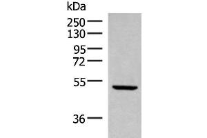 Western blot analysis of Rat heart tissue lysate using PSMD12 Polyclonal Antibody at dilution of 1:300 (PSMD12 antibody)