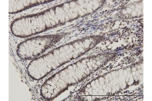 Immunoperoxidase of monoclonal antibody to RPL14 on formalin-fixed paraffin-embedded human colon. (RPL14 antibody  (AA 1-90))