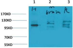 Western Blot (WB) analysis of 1) Human Brain Tissue, 2)Mouse Brain Tissue, 3) Rat Brain Tissue with Glutamate Receptor 1 Rabbit Polyclonal Antibody diluted at 1:2000.