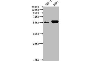 Western Blot Positive WB detected in: THP-1 whole cell lysate, U251 whole cell lysate All lanes: IRAK4 antibody at 1:2000 Secondary Goat polyclonal to rabbit IgG at 1/50000 dilution Predicted band size: 52, 38 kDa Observed band size: 55 kDa (Recombinant IRAK4 antibody)